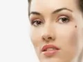علائم هشدار دهنده در مورد خال ها