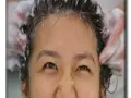 ماساژ پوست سر و طاسی