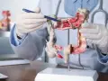 همه‌چیز درباره مگاکولون سمی: علائم، علل و درمان