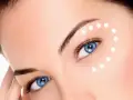 چند کرم دور چشم خانگی بسازید