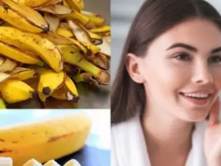 معجزه ی پوست موز برای زیبایی