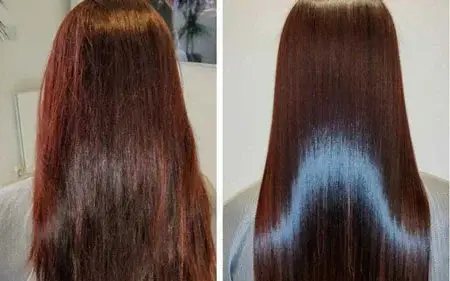 تراپی مو چیست؟ + معرفی انواع آن