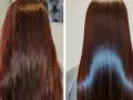 تراپی مو چیست؟ + معرفی انواع آن